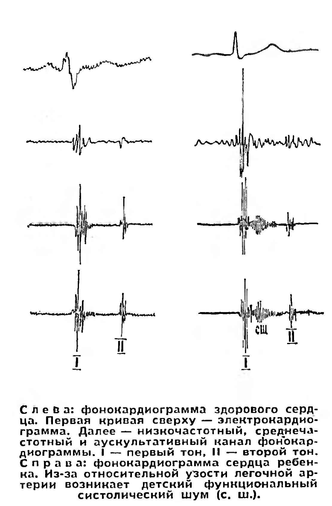 ЗВУКИ СЕРДЦА
