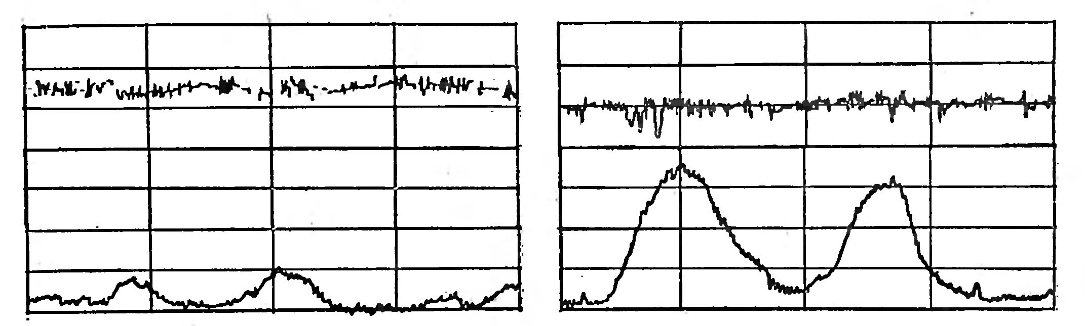 КОММЕНТАРИИ К СТАТЬЕ АКАД. АМН СССР Н. ЮДАЕВА