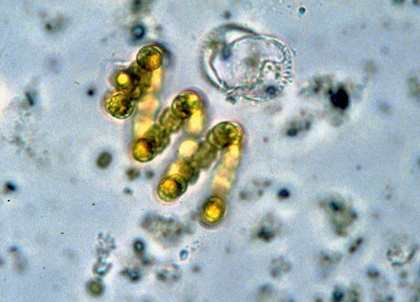 Как микроскопические водоросли заставили отказаться от биотоплива