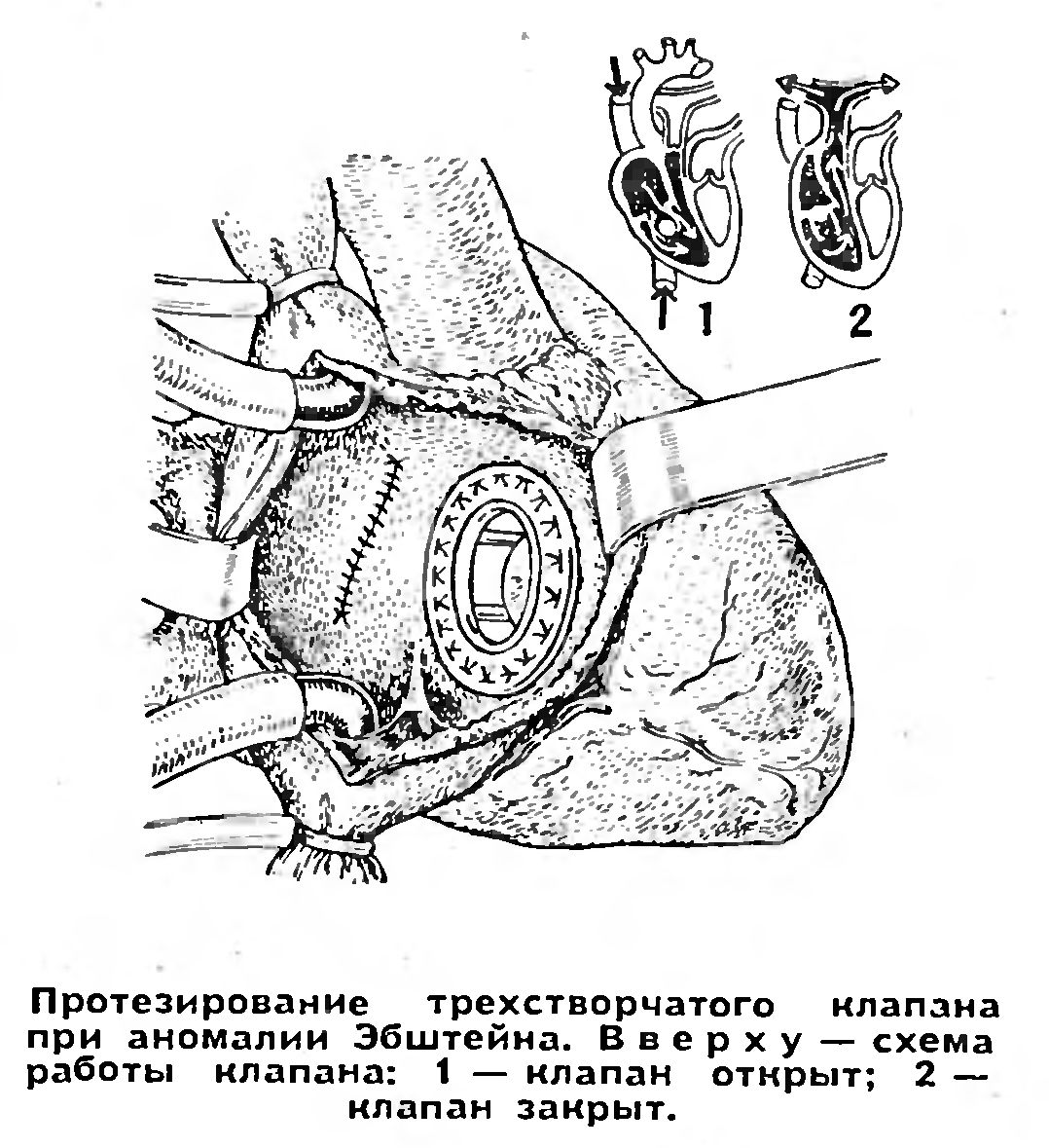 СОЗИДАЮЩАЯ ХИРУРГИЯ (РЕПОРТАЖ ИЗ ИНСТИТУТА)