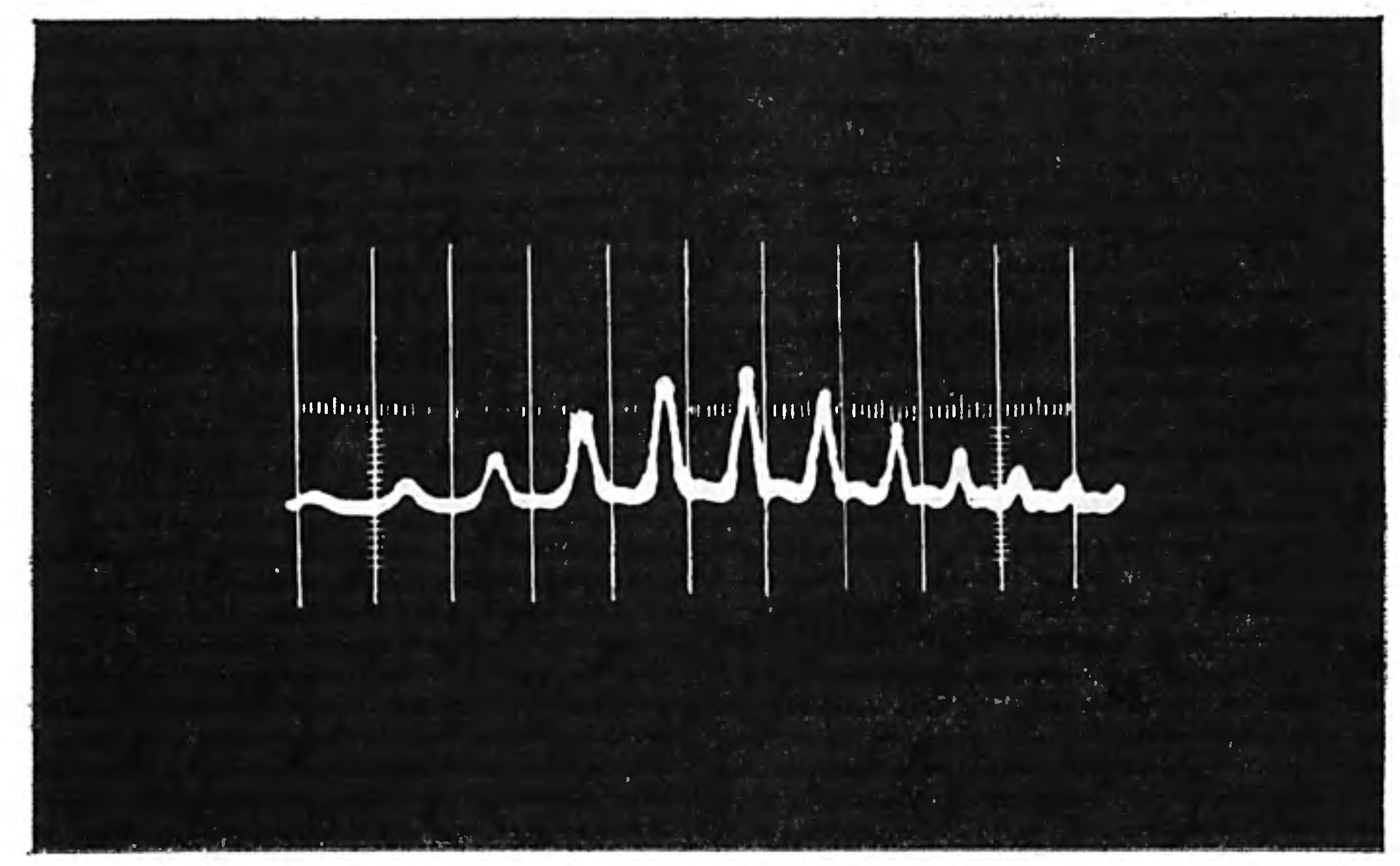 СВЕТОВАЯ ПУЛЯ