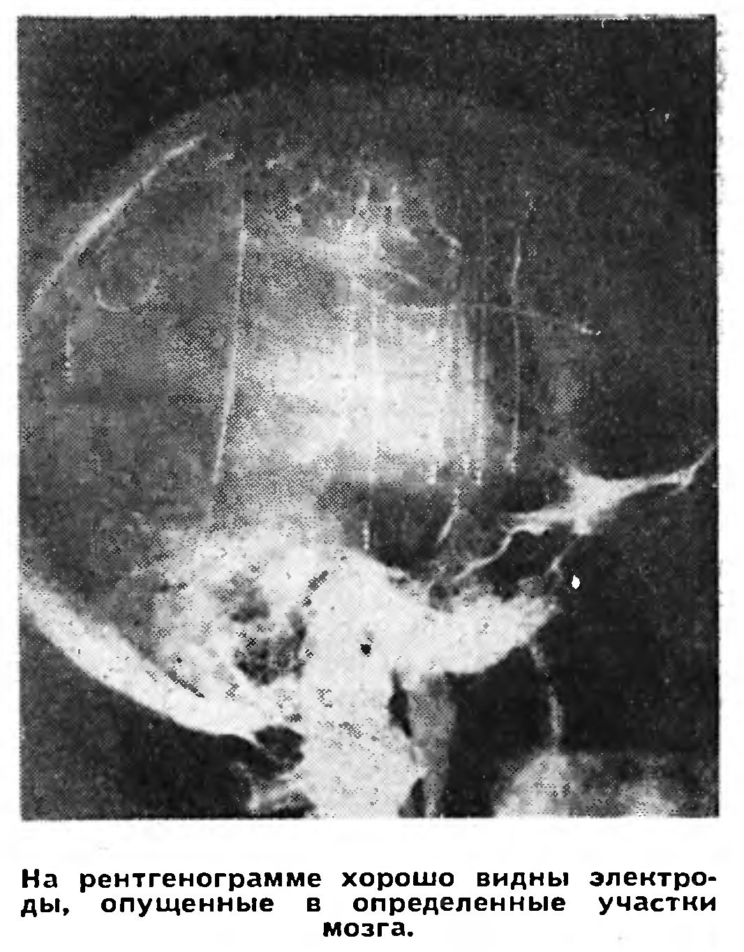 ПОЗНАНИЕ МОЗГА ПРОДОЛЖАЕТСЯ