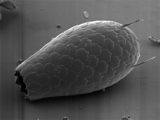 Панцирь раковинной амёбы из рода Euglypha. Фото: NEON/Wikimedia Commons CC BY-SA 2.5