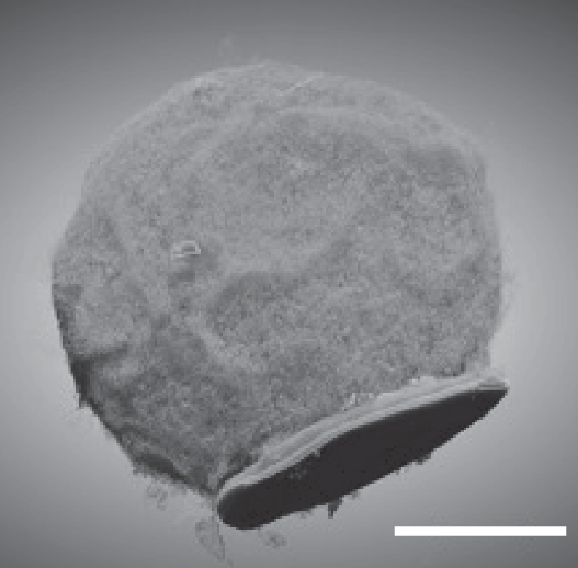 моноцит с имплантатом.png моноцит с имплантатом.png