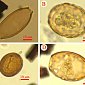 Жители боспорского Мирмекия страдали от кишечных паразитов